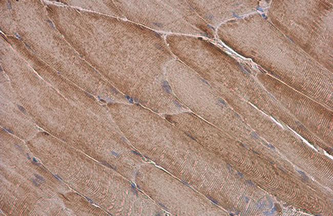 MYL2 Antibody in Immunohistochemistry (Paraffin) (IHC (P))