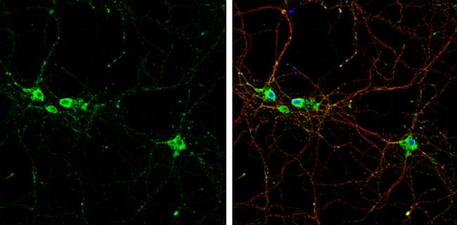 TrkB Antibody in Immunocytochemistry (ICC/IF)