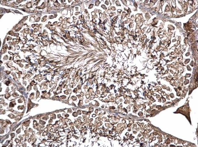 ODF2 Antibody in Immunohistochemistry (Paraffin) (IHC (P))