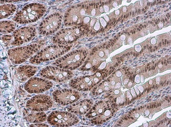 Phospho-PDCD4 (Ser457) Antibody in Immunohistochemistry (Paraffin) (IHC (P))