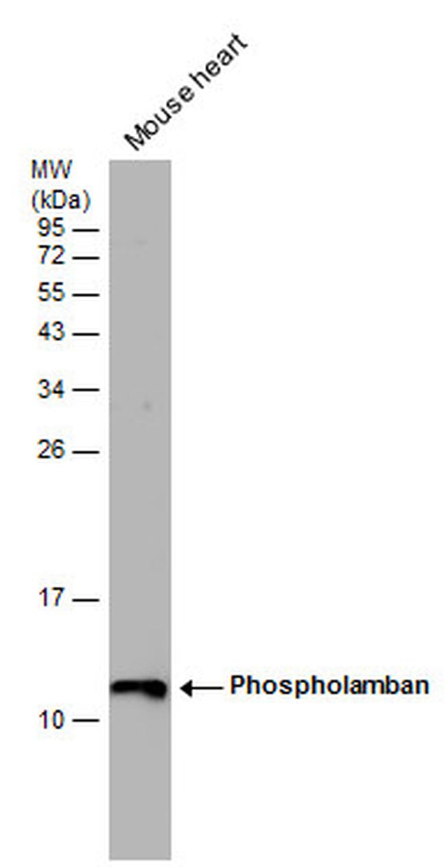 Phospholamban Antibody in Western Blot (WB)