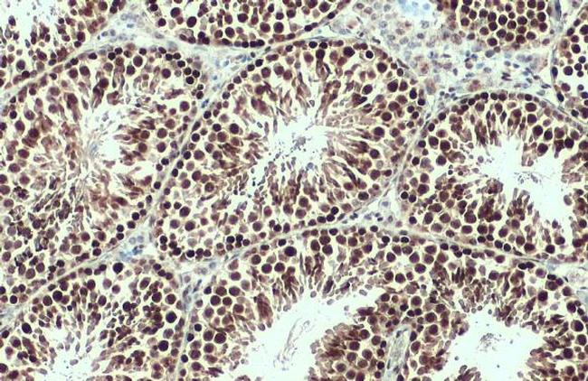 Brachyury Antibody in Immunohistochemistry (Paraffin) (IHC (P))