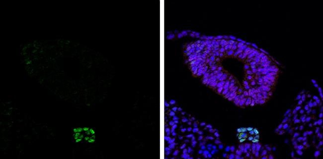 Brachyury Antibody in Immunohistochemistry (Paraffin) (IHC (P))