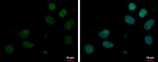 MYT1L Antibody in Immunocytochemistry (ICC/IF)