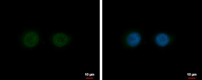 Nesprin 2 Antibody in Immunocytochemistry (ICC/IF)