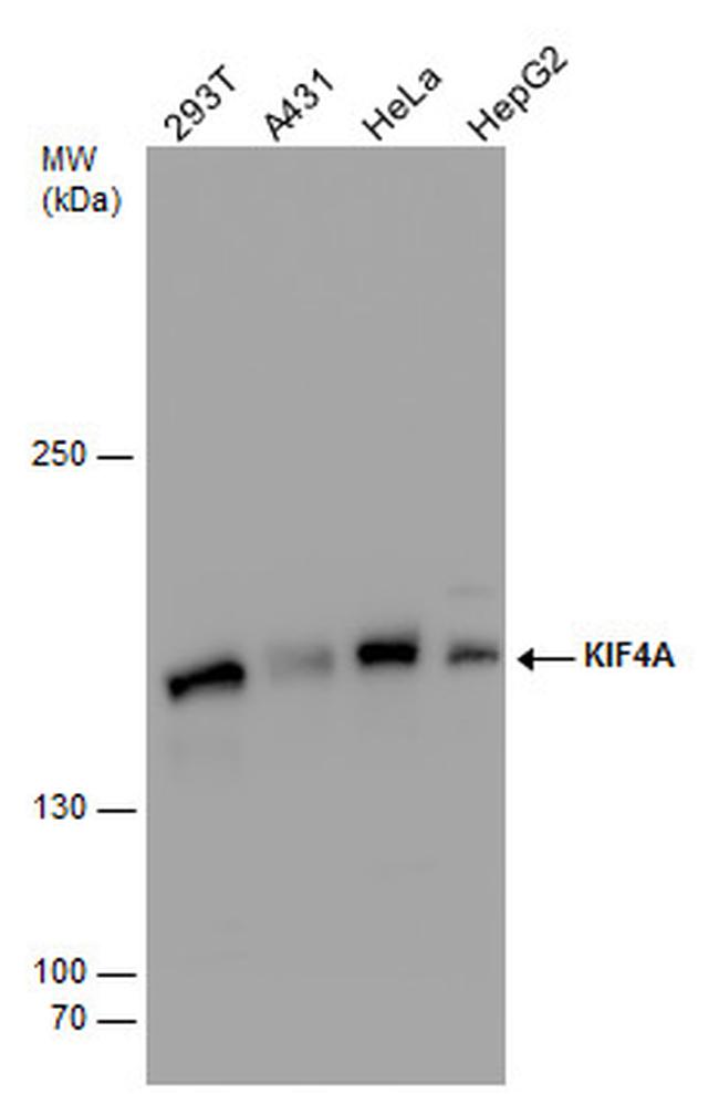 KIF4A Antibody in Western Blot (WB)