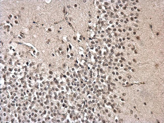 PRPF31 Antibody in Immunohistochemistry (Paraffin) (IHC (P))