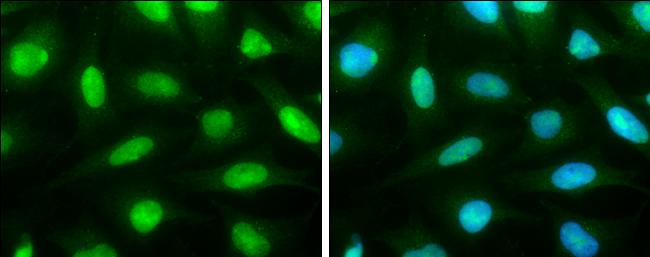 TRMT2A Antibody in Immunocytochemistry (ICC/IF)