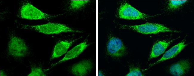 Lass2 Antibody in Immunocytochemistry (ICC/IF)