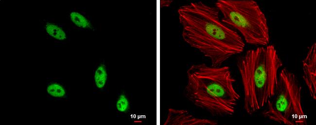 SOX8 Antibody in Immunocytochemistry (ICC/IF)