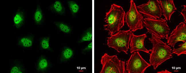 TET2 Antibody in Immunocytochemistry (ICC/IF)