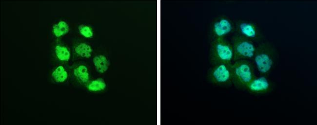 XPO5 Antibody in Immunocytochemistry (ICC/IF)