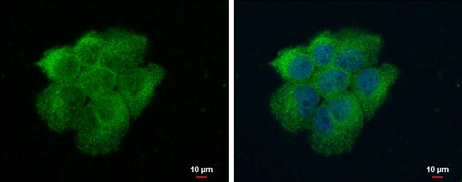 VPS18 Antibody in Immunocytochemistry (ICC/IF)