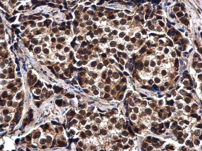 ELAC2 Antibody in Immunohistochemistry (Paraffin) (IHC (P))