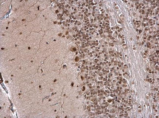 IPO5 Antibody in Immunohistochemistry (Paraffin) (IHC (P))