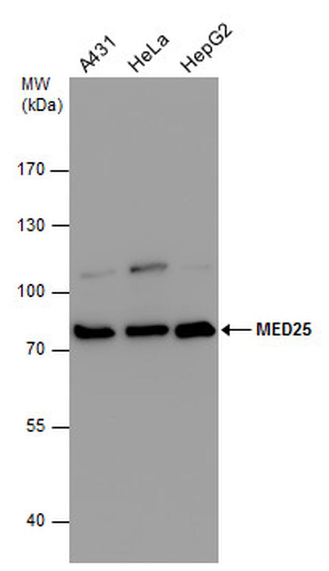 MED25 Antibody in Western Blot (WB)