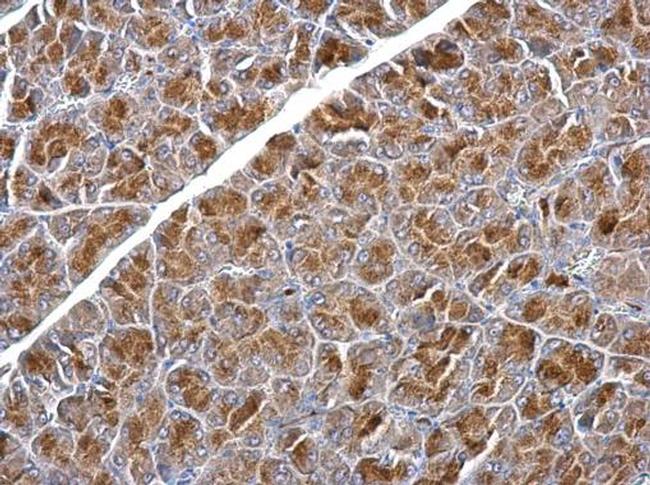 SNX25 Antibody in Immunohistochemistry (Paraffin) (IHC (P))