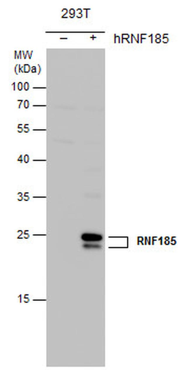 RNF185 Antibody in Western Blot (WB)