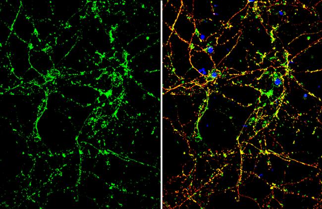 OTUB1 Antibody in Immunocytochemistry (ICC/IF)