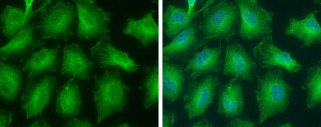 GNPDA2 Antibody in Immunocytochemistry (ICC/IF)