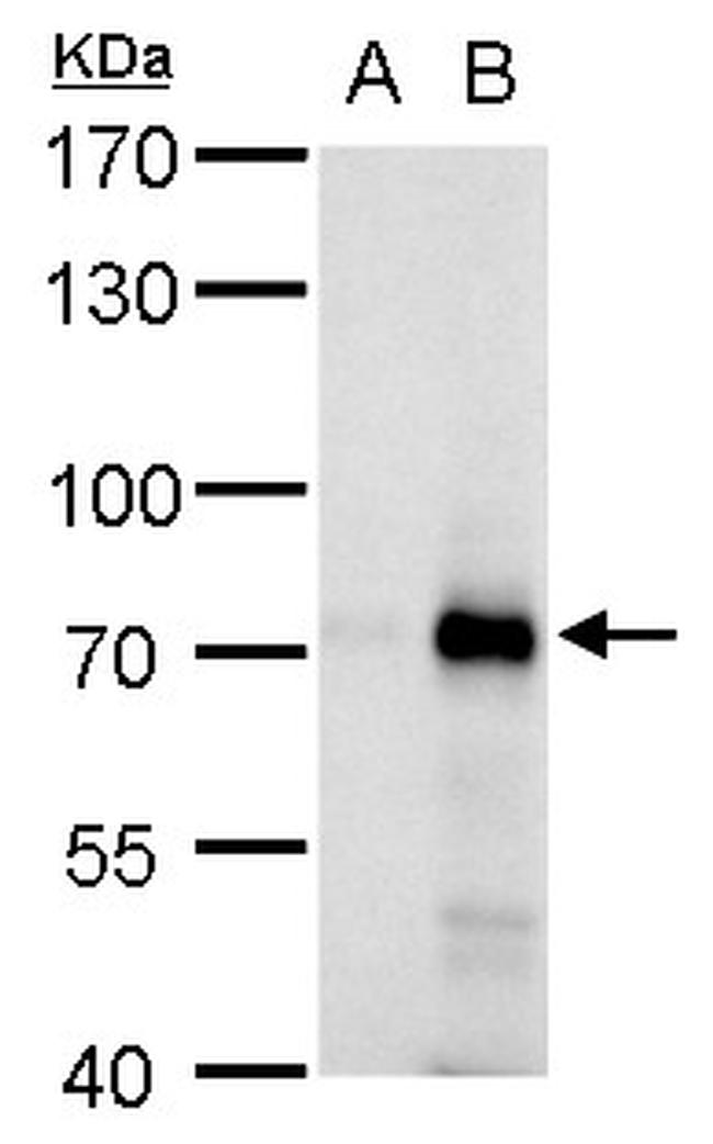 RNF168 Antibody in Western Blot (WB)