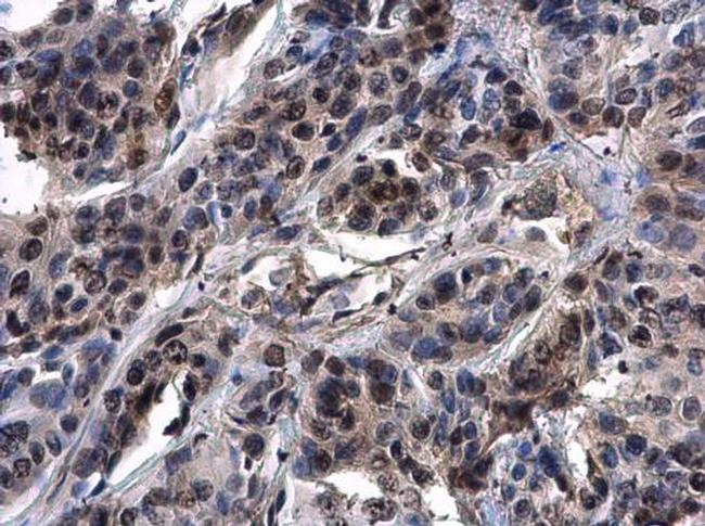 ASXL1 Antibody in Immunohistochemistry (Paraffin) (IHC (P))