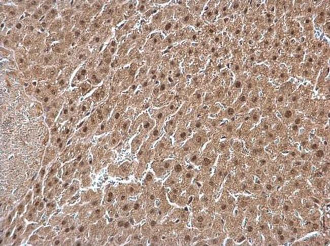 GPS1 Antibody in Immunohistochemistry (Paraffin) (IHC (P))