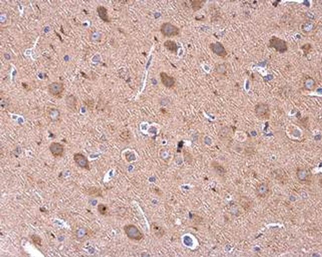 GDF6 Antibody in Immunohistochemistry (Paraffin) (IHC (P))