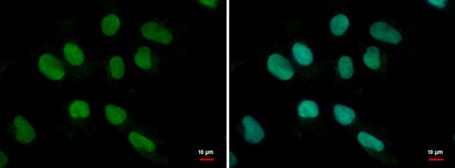 MEF2B Antibody in Immunocytochemistry (ICC/IF)