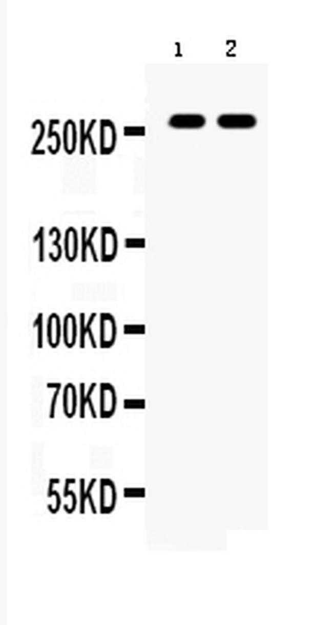 ABCA4 Antibody in Western Blot (WB)