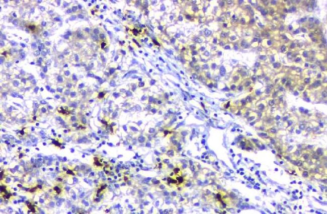 ABCB4 Antibody in Immunohistochemistry (Paraffin) (IHC (P))