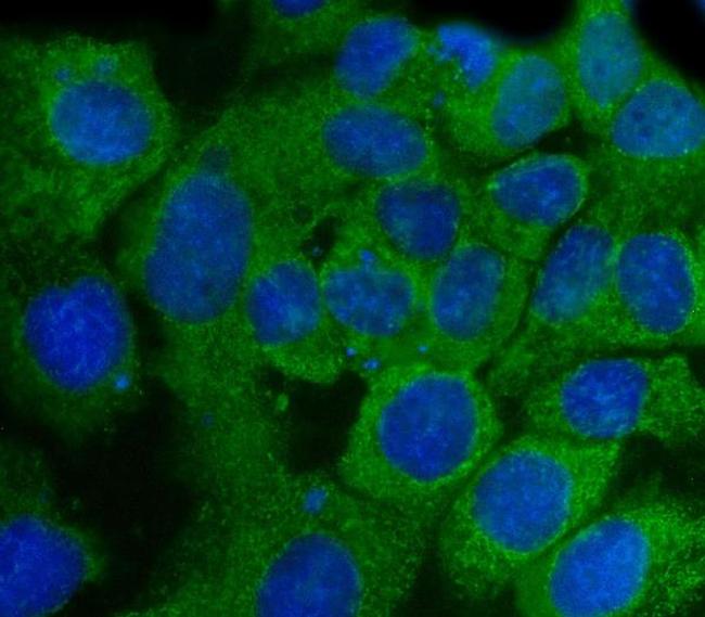 ABI1 Antibody in Immunocytochemistry (ICC/IF)