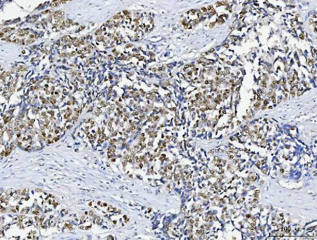 ABL2 Antibody in Immunohistochemistry (Paraffin) (IHC (P))