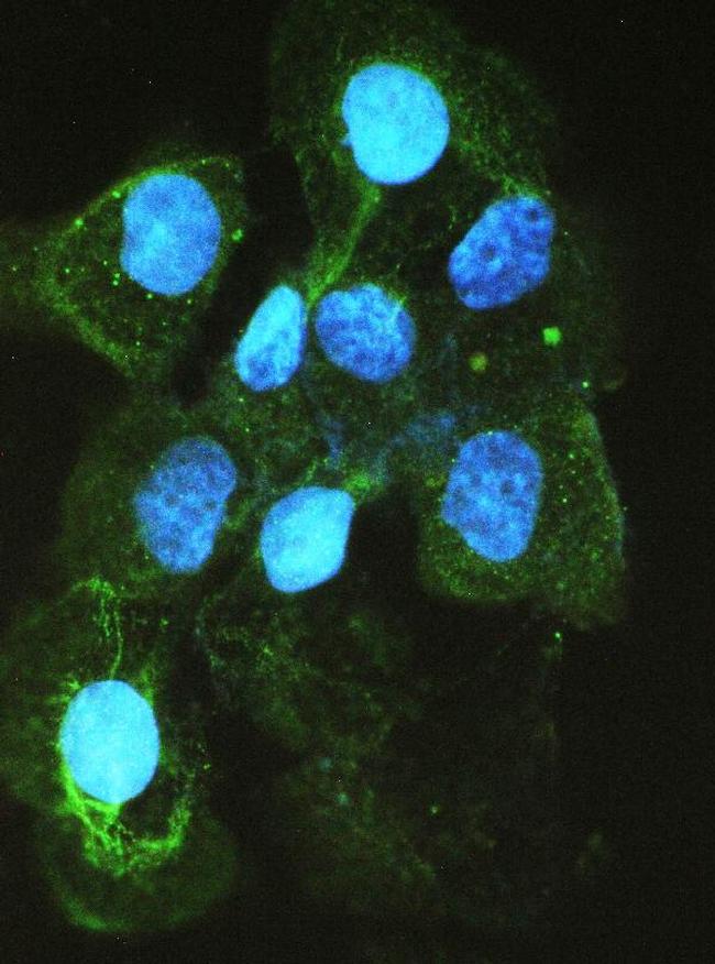 ACE Antibody in Immunocytochemistry (ICC/IF)