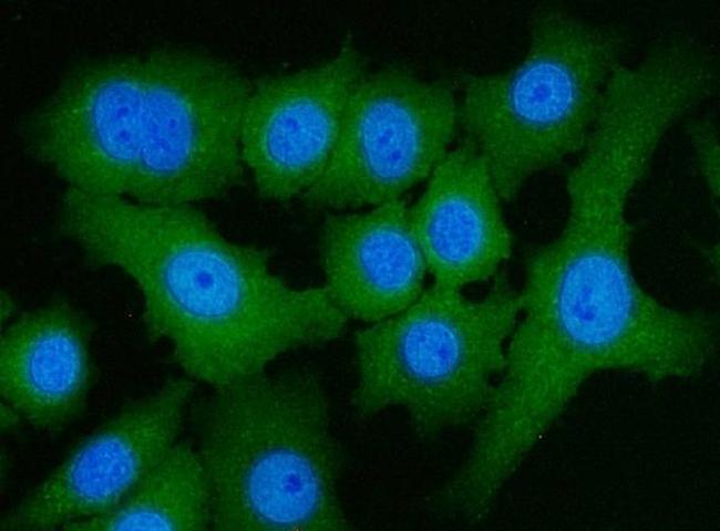 ATP Citrate Lyase Antibody in Immunocytochemistry (ICC/IF)