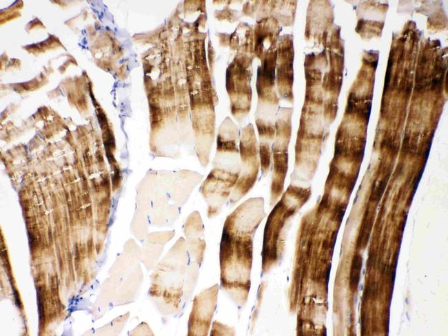 alpha Actinin 3 Antibody in Immunohistochemistry (Paraffin) (IHC (P))