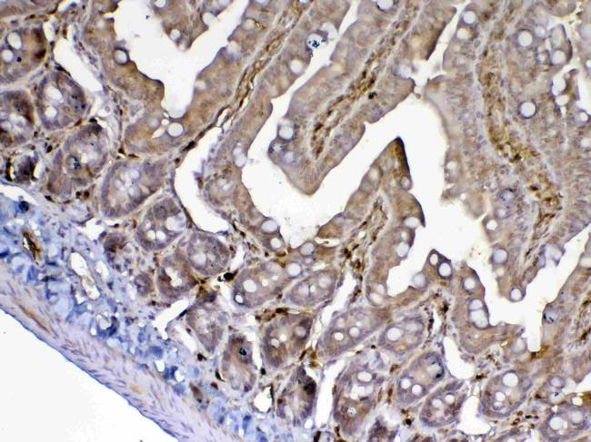 Adenosine Deaminase Antibody in Immunohistochemistry (Paraffin) (IHC (P))