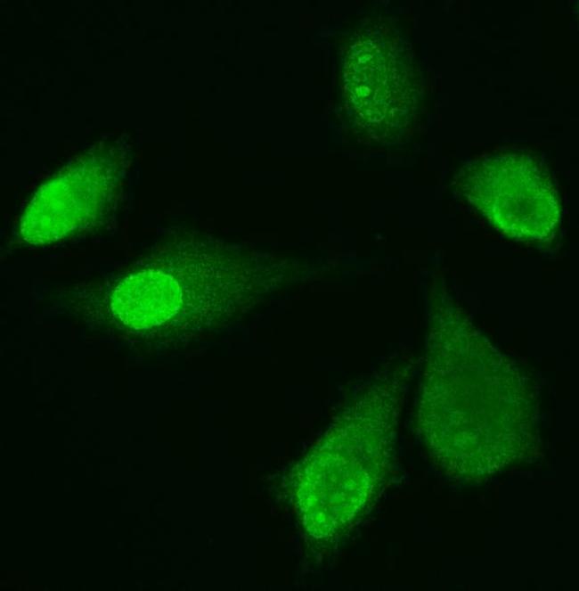 ADK Antibody in Immunocytochemistry (ICC/IF)