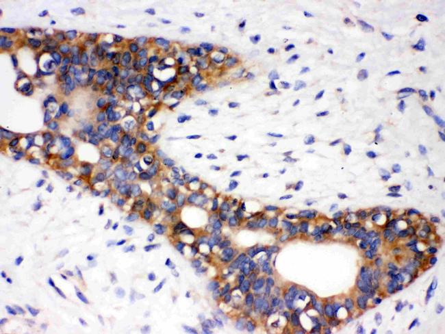 AGTR1 Antibody in Immunohistochemistry (Paraffin) (IHC (P))