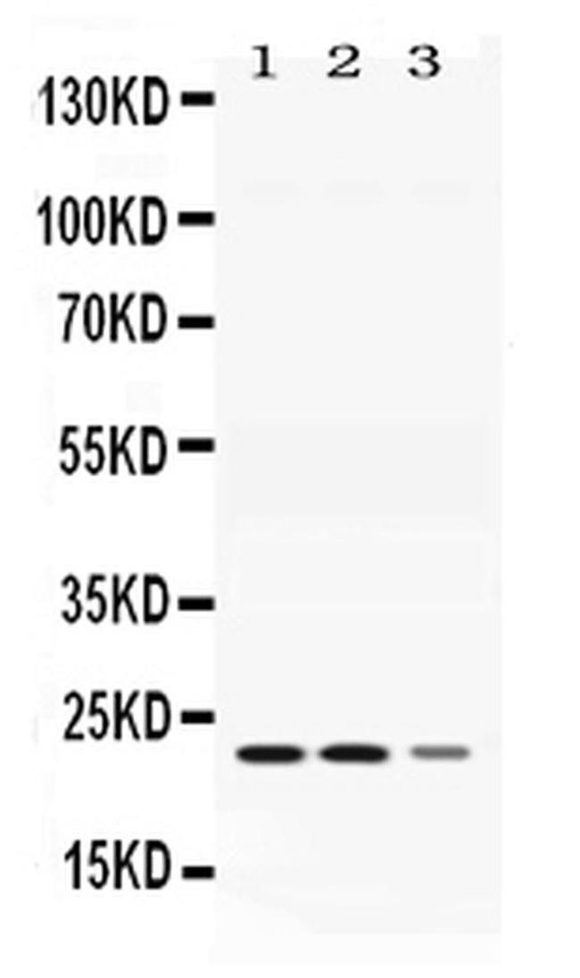 Adenylate Kinase 1 Antibody in Western Blot (WB)