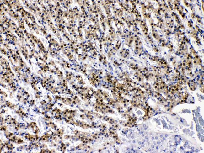 AKR1B1 Antibody in Immunohistochemistry (Paraffin) (IHC (P))