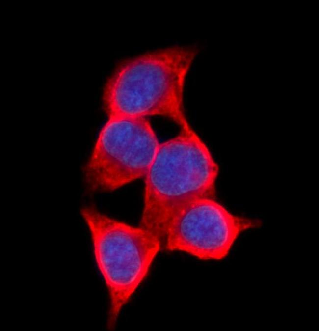 AKR1C1/AKR1C2 Antibody in Immunocytochemistry (ICC/IF)