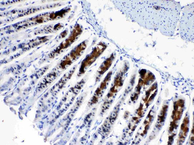 CD166 (ALCAM) Antibody in Immunohistochemistry (Paraffin) (IHC (P))