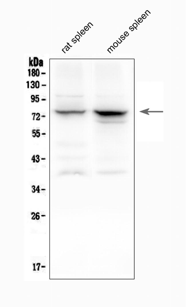 ALOX12 Antibody in Western Blot (WB)