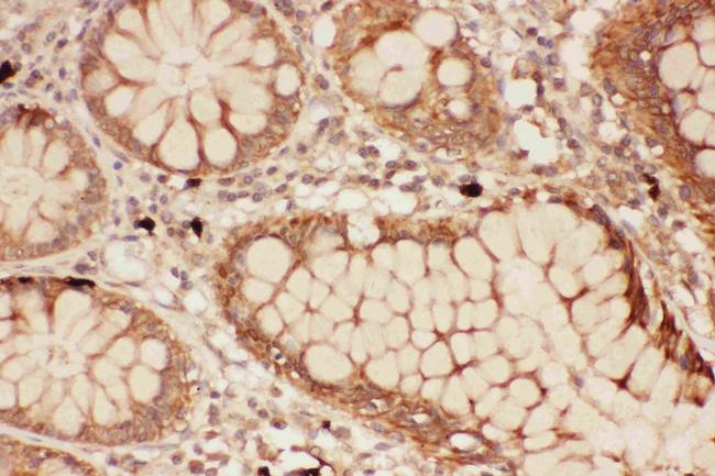 ALOX15 Antibody in Immunohistochemistry (Paraffin) (IHC (P))