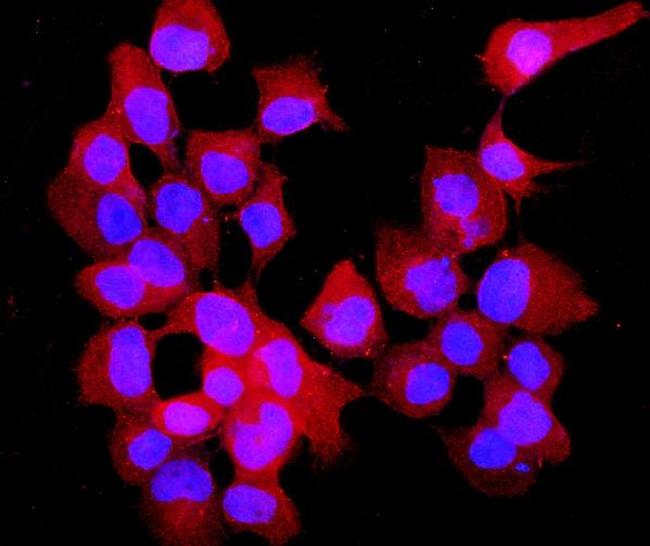 Annexin VII Antibody in Immunocytochemistry (ICC/IF)