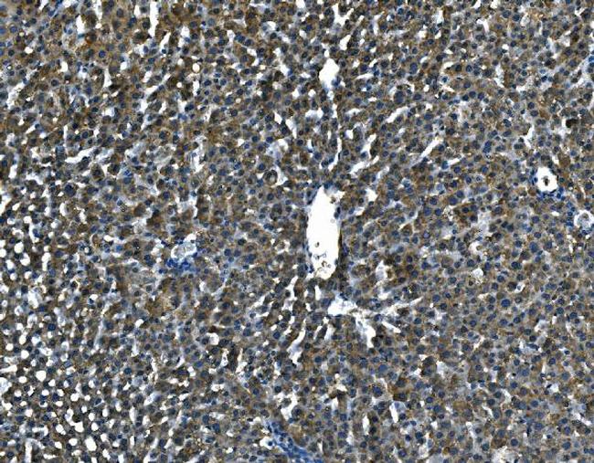 Serum Amyloid P Antibody in Immunohistochemistry (Paraffin) (IHC (P))