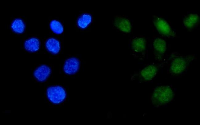 API5 Antibody in Immunocytochemistry (ICC/IF)