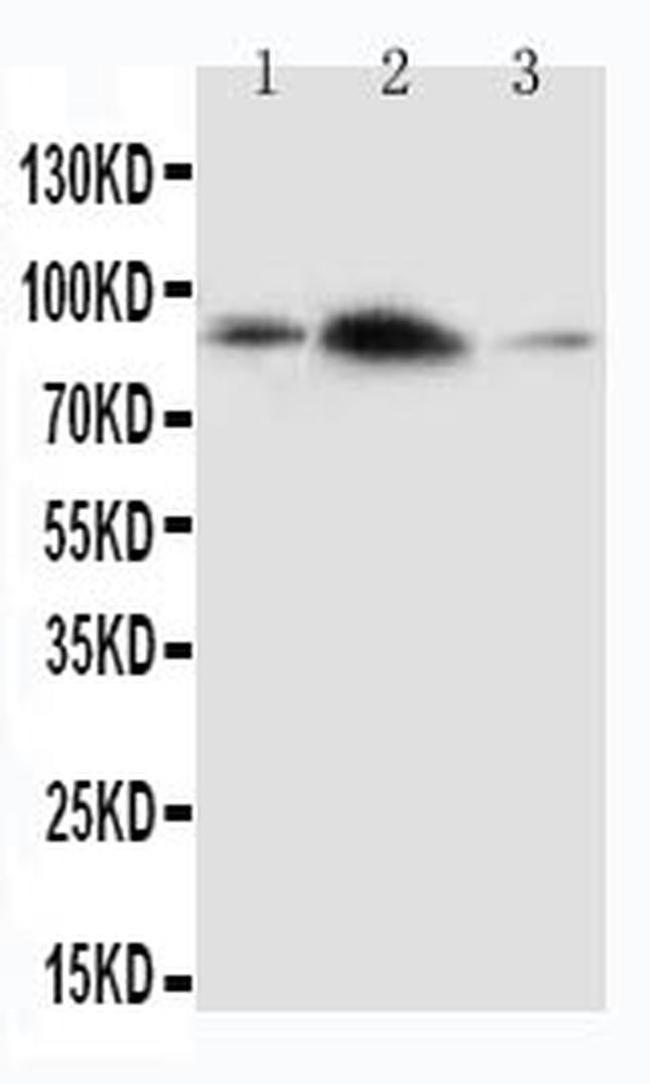 APLP2 Antibody in Western Blot (WB)