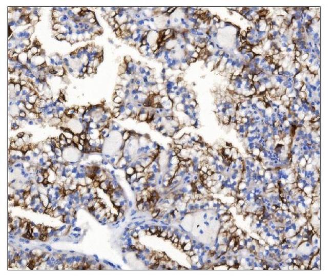 Aquaporin 1 Antibody in Immunohistochemistry (Paraffin) (IHC (P))